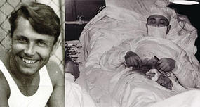 Leonid Rogozov removed his own appendix under local anesthesia by himself