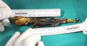 Atacama Skeleton